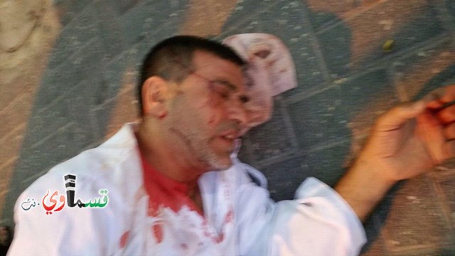 الشرطة: اعتقال عرب بشبهة الاعتداء على أبو شرخ والخلفية جنائية - العائلة: هذا تضليل